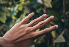 Perubahan Warna Kuku Bisa Jadi Tanda Kolesterol Tinggi