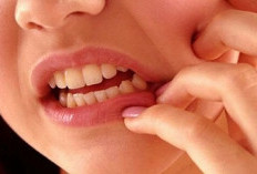  Masalah Gigi, Hipertensi, Diabetes, dan Obesitas Dominasi Hasil CKG 