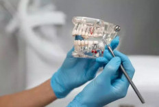  Gigi Goyang Bisa Jadi Sinyal Kerusakan Gusi dan Tulang Penyangga