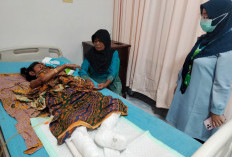 Gegara Obat Nyamuk, Wanita Keterbelakangan Mental Alami Luka Bakar 