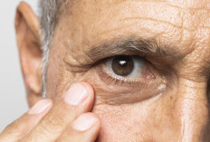 Waspadai Minus Tinggi! Dewi Yull Alami Kebutaan Mata Kanan karena Ablasi Retina
