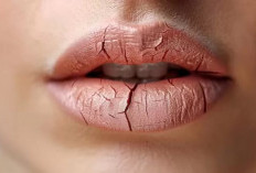 Cegah Bibir Kering dan Pecah-Pecah saat Puasa 
