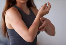  Waspada Gejala Kusta yang Muncul Bertahap!